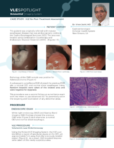 VLE-for-Post-Treatment-Assessment---Dr.-Viren-Joshi--232x300.png